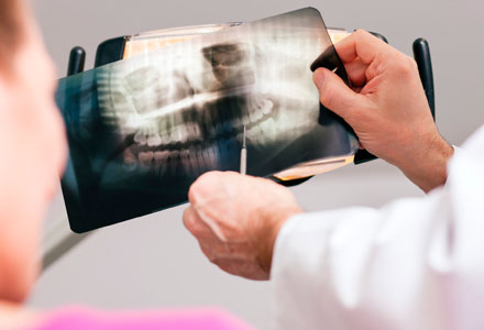 Radiografia Odontológica em São Paulo