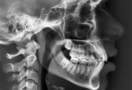 Radiografia Odontológica em São Paulo